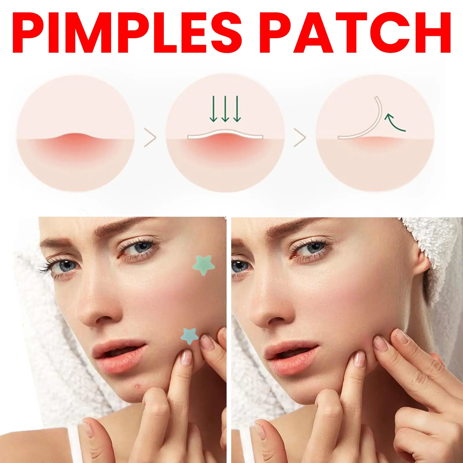 QUSTERE Pimple Patches for Face, Hydrocolloid Acne Patches, Cute Star Zit Covers, Colorful Spot Stickers with Tea Tree, Salicylic Acid & Cica Oil 200 Count Skincare Skin Repair