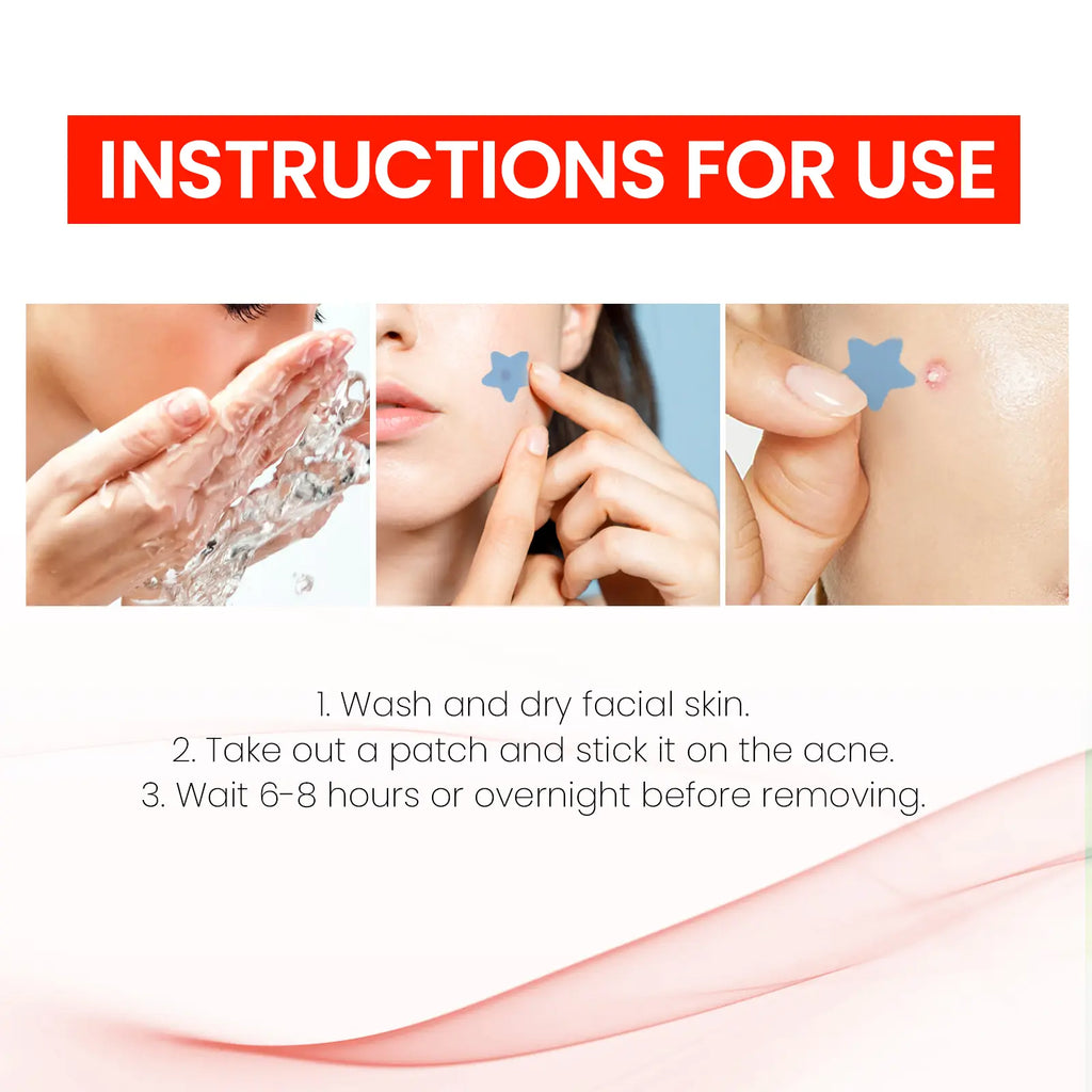 QUSTERE Pimple Patches for Face, Hydrocolloid Acne Patches, Cute Star Zit Covers, Colorful Spot Stickers with Tea Tree, Salicylic Acid & Cica Oil 200 Count Skincare Skin Repair