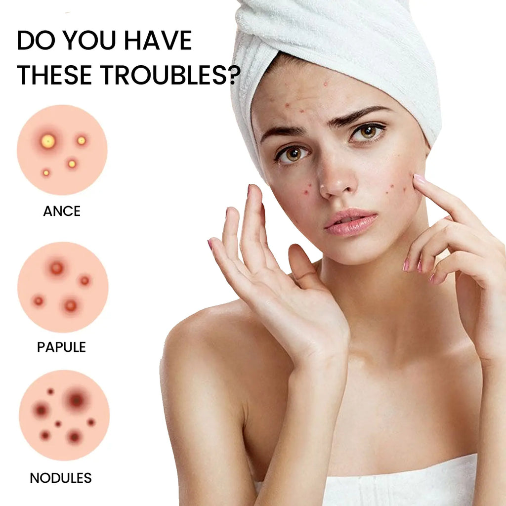 QUSTERE Pimple Patches for Face, Hydrocolloid Acne Patches, Cute Star Zit Covers, Colorful Spot Stickers with Tea Tree, Salicylic Acid & Cica Oil 200 Count Skincare Skin Repair